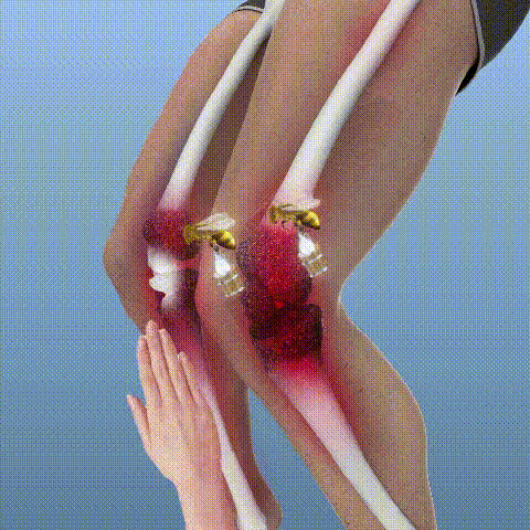 2x1 ArtiBee® (Gel de veneno de abeja, para aliviar dolor)